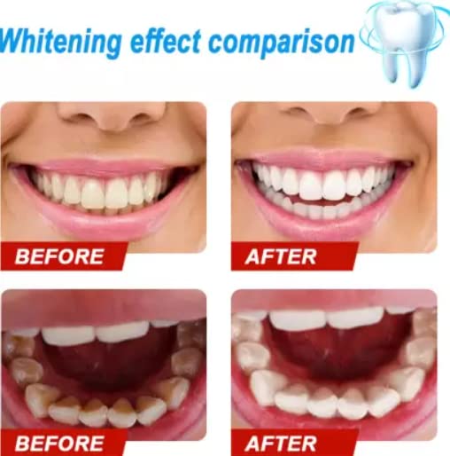 EFERO Teeth Whitening Bleaching Cleaning Serum Teeth Whitening Liquid Oral Hygiene Tooth Whitening