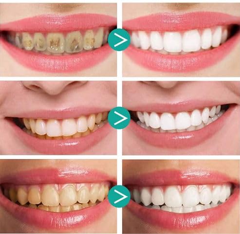 Ramley Products Sparkling Smile Teeth Whitening Foam Toothpaste - Advanced Dental Care for Brighter, Whiter Smile, Radiant Smile 60ml