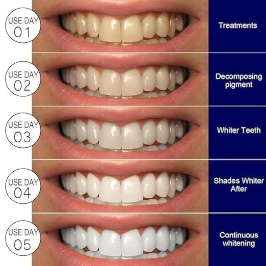 samtrish Teeth Whitening Strips | Tooth Bleaching White Strips | 7 PAIR (14 PCS) White Strips Suit for Sensitive Teeth Whitener for Removing Smoking Coffee Stain