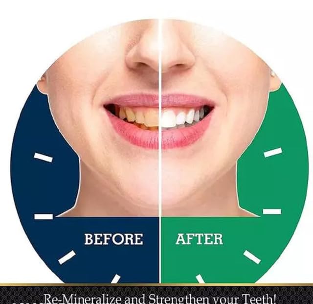 KALP ENTERPRISE 7DAYS RESULT FOR Teeth Whitening foam Make your Sparkle Teeth Whitening Liquid(60 ml)