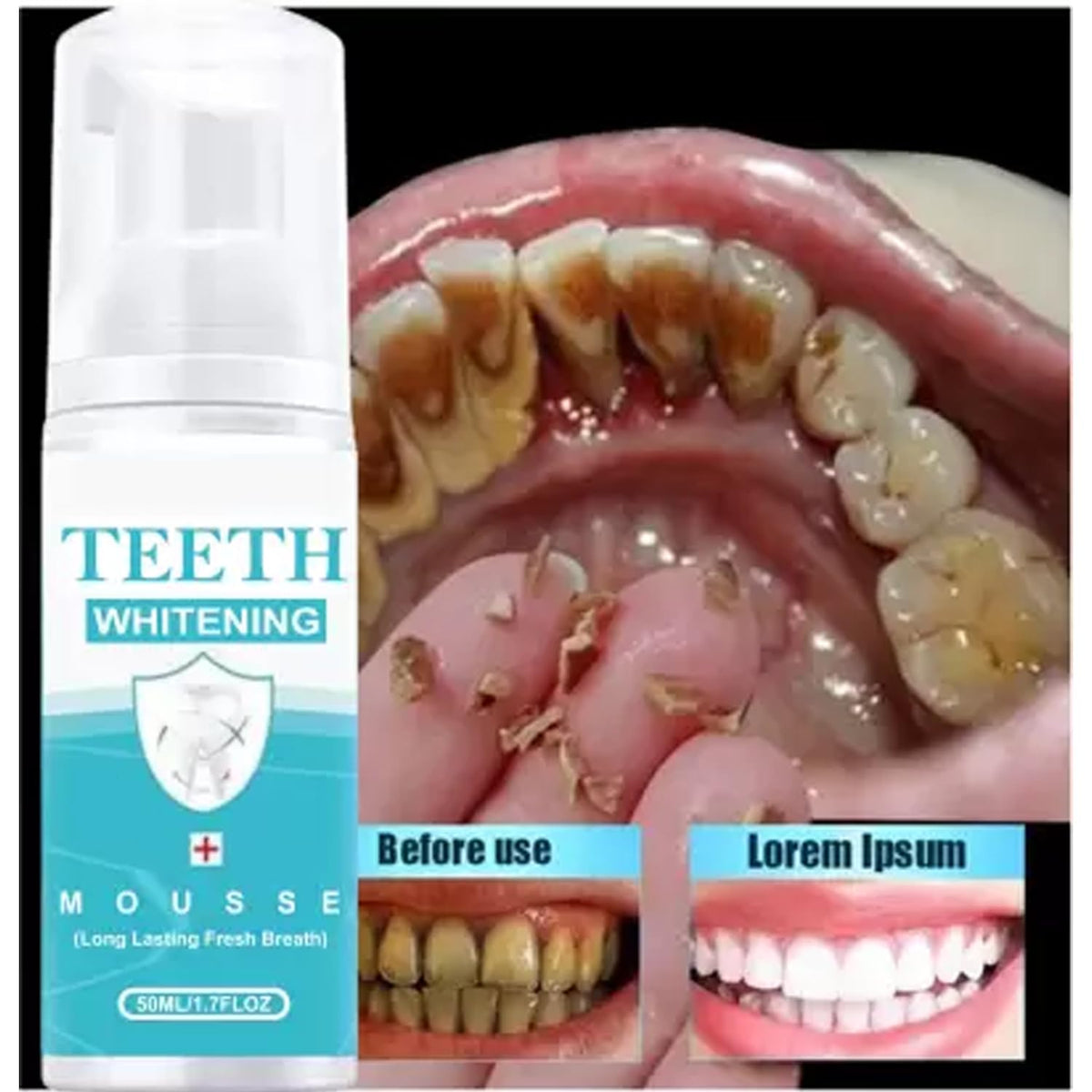 Whitening Dental Mousse,Tea Stain Removal Foaming Tooth Cleanser Travel-Size Dentist Formulated [50ml]