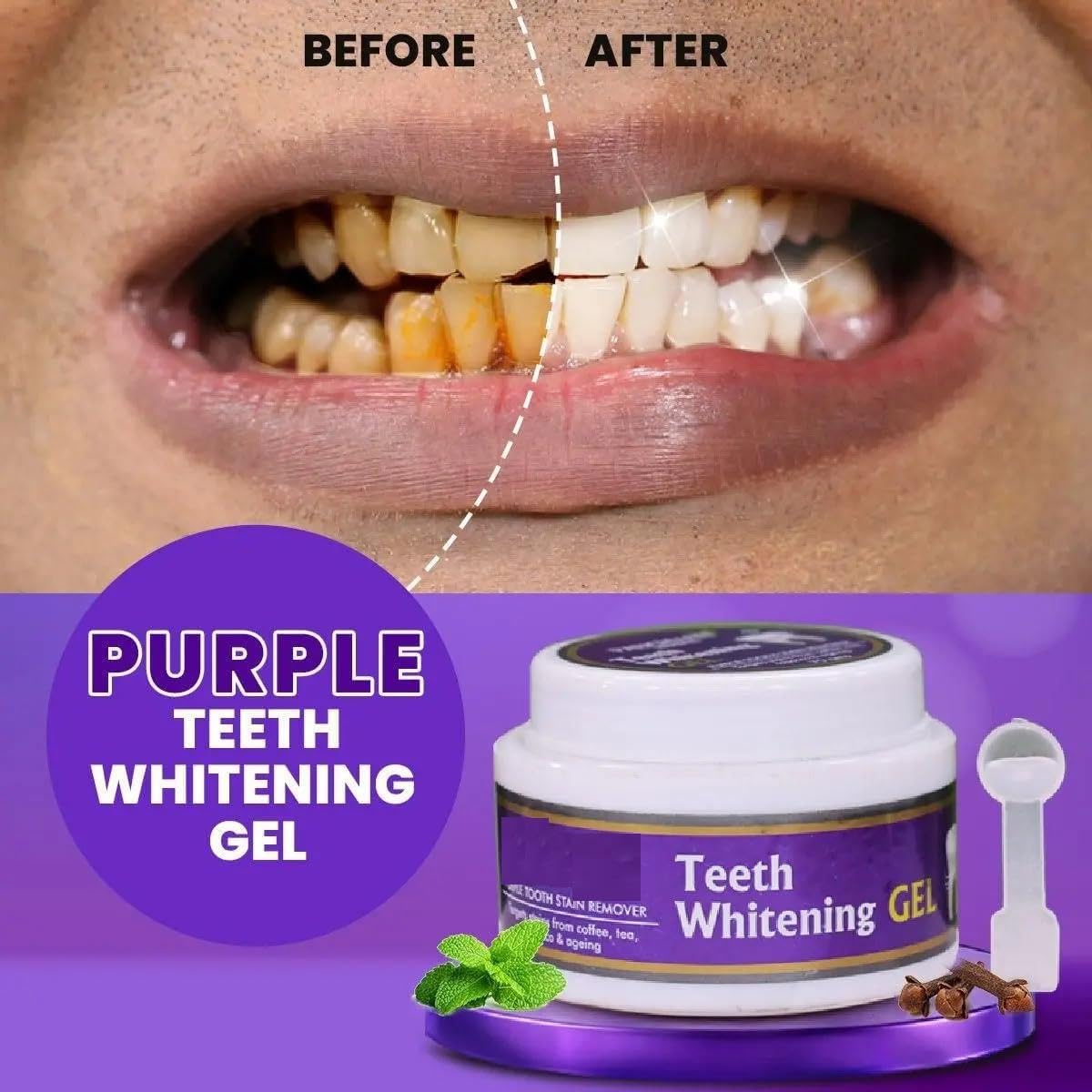 Purple Teeth Whitening Gel| Alcohol Free | Mouth freshner With Active Ingredients| No Artificial Colors | Suitable for Men, Women, Children | 50g