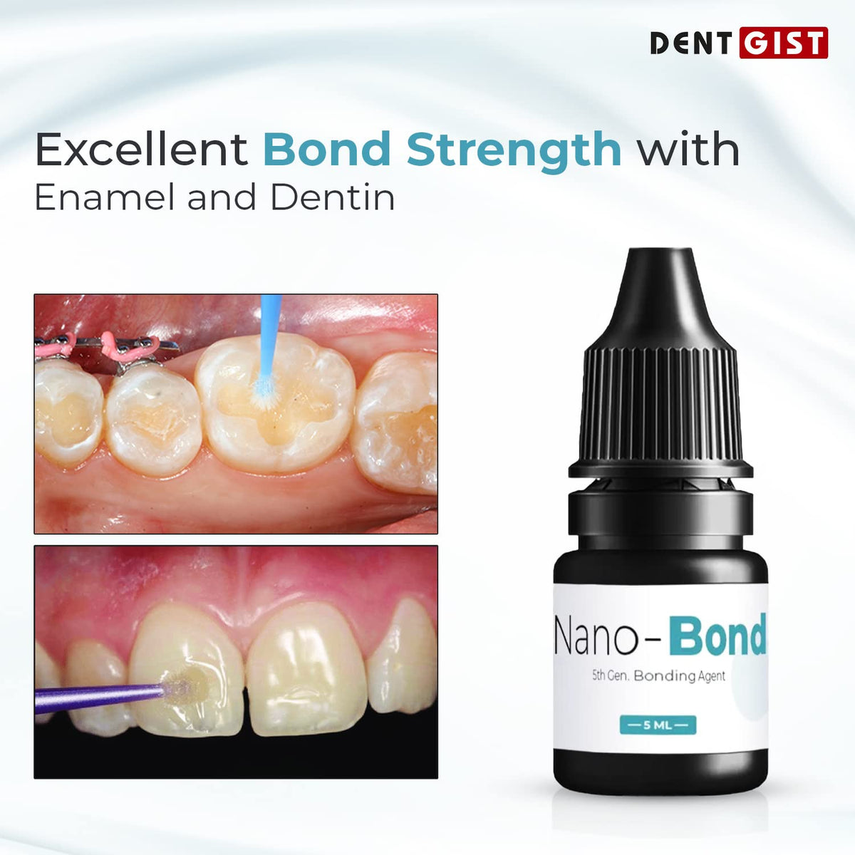 DentGist Nano-Bond | Light Curing Single Component 5th Gen Bonding Agent | Adhesive System