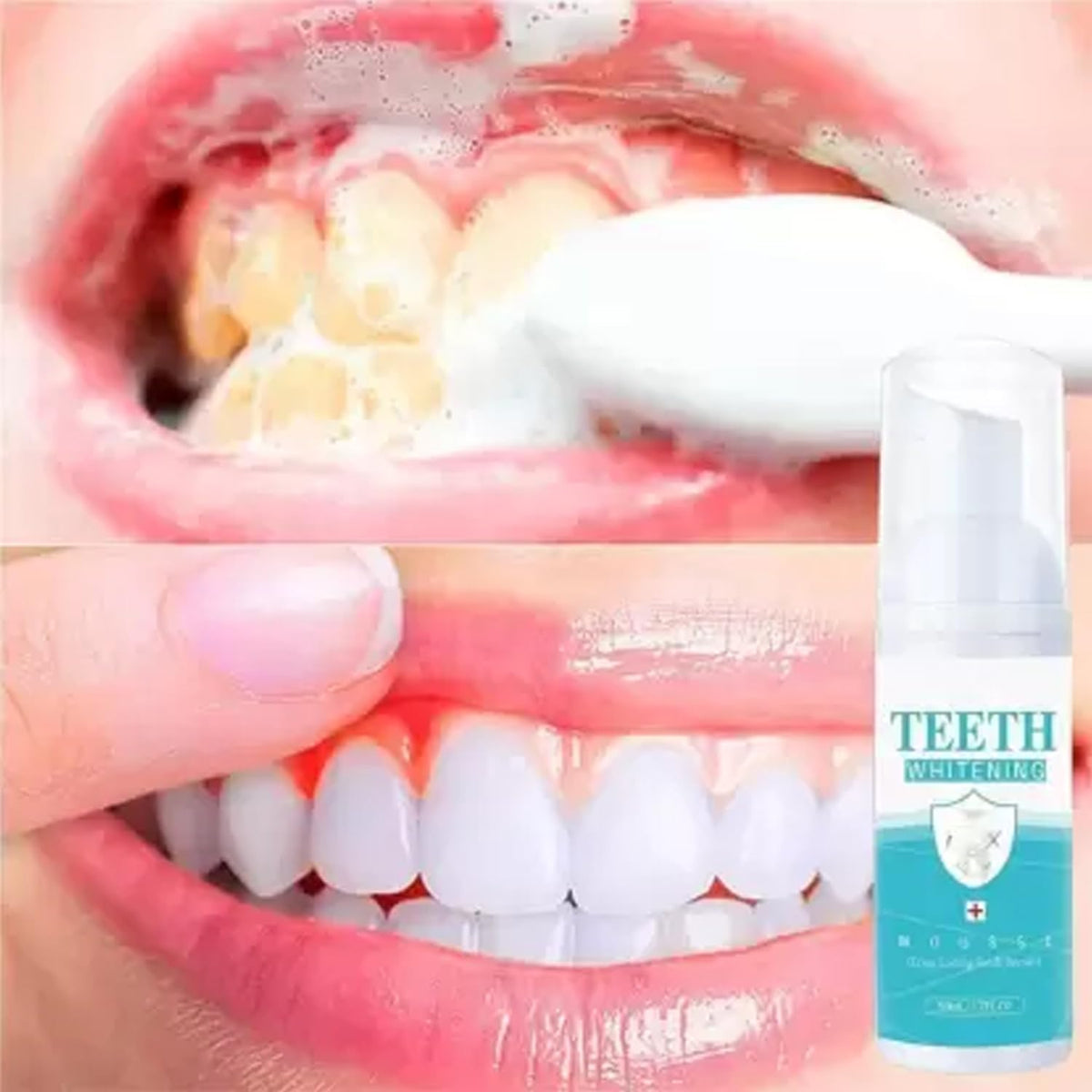 Whitening Dental Mousse,Tea Stain Removal Foaming Tooth Cleanser Travel-Size Dentist Formulated [50ml]