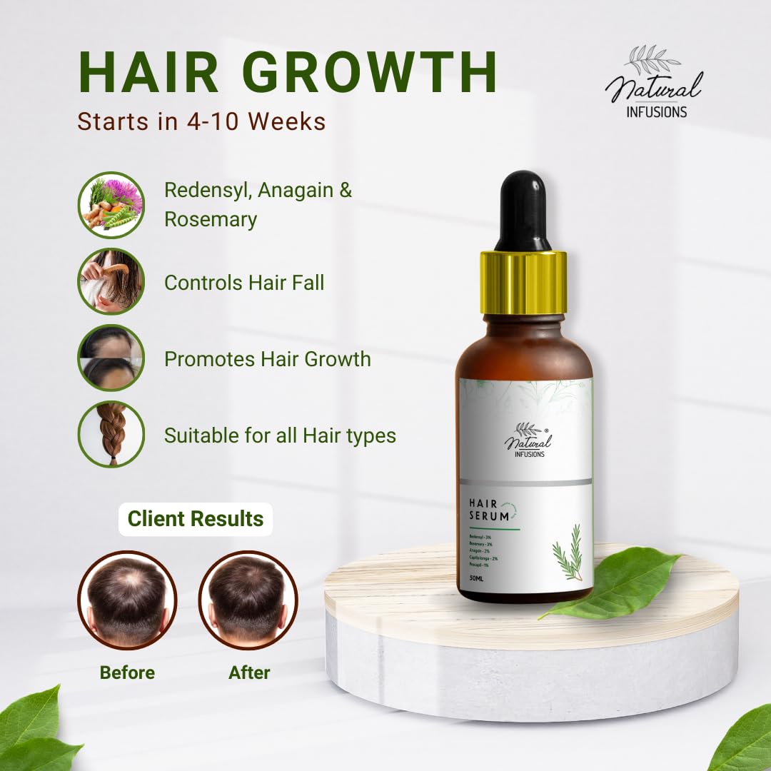 Natural Infusions Hair Growth Serum (50ml) | Redensyl, Anagain, Rosemary, Procapil, & Capila Longa | Controls Hair Fall | Increase Hair Density | For Men and Women | (Pack of 1)