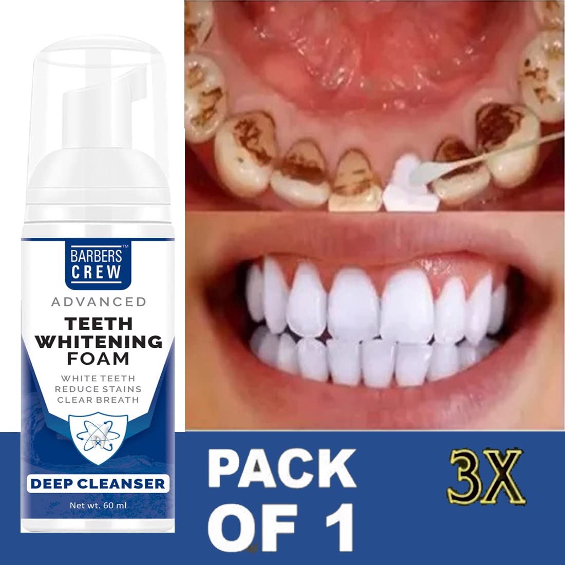 Barbers Crew Teeth Cleansing Foam To Remove Yellow Stains Tartar and Tobacco Stains 60 ML