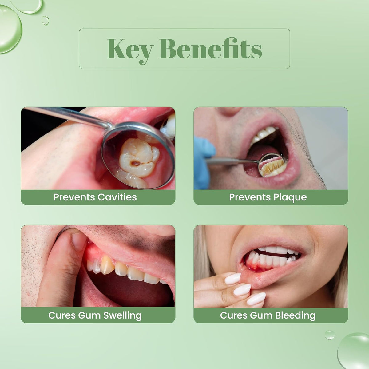 I2cure Tooth & Gum Gel | Prevents Gum Swelling, bleeding & infections | Treats Mouth Ulcers and Oral Cavities | 20 ml