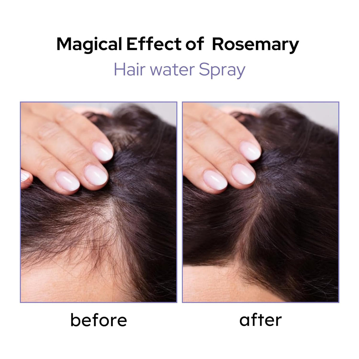 SUNSHREE Rosemary Water for Hair Growth, Hair Fall Control |100% Pure & Natural | ANTI-HAIRFALL GROWTH THERAPY | Skin, Body & Hair Mist-100mL (Pack of 1)