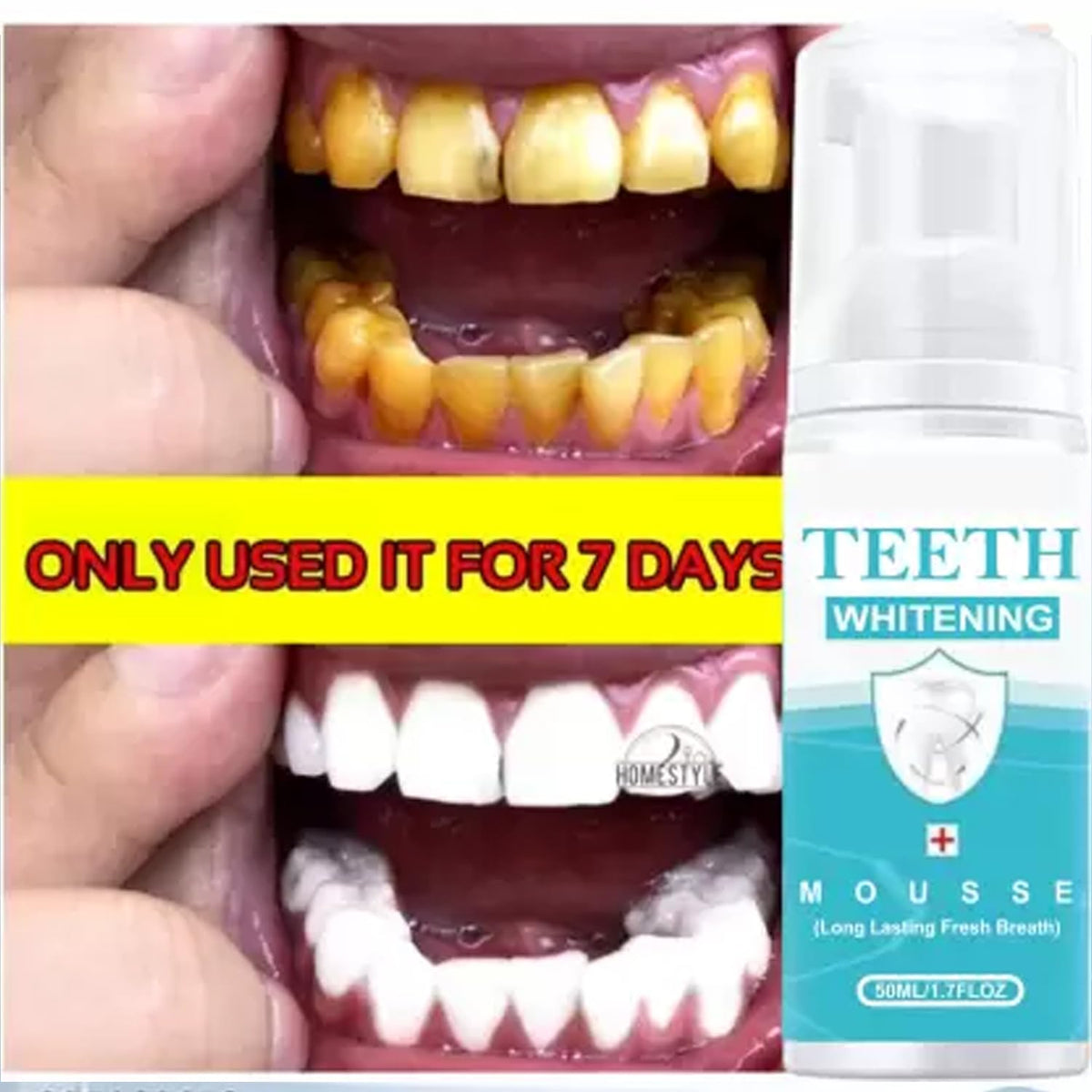 Whitening Dental Mousse,Tea Stain Removal Foaming Tooth Cleanser Travel-Size Dentist Formulated [50ml]