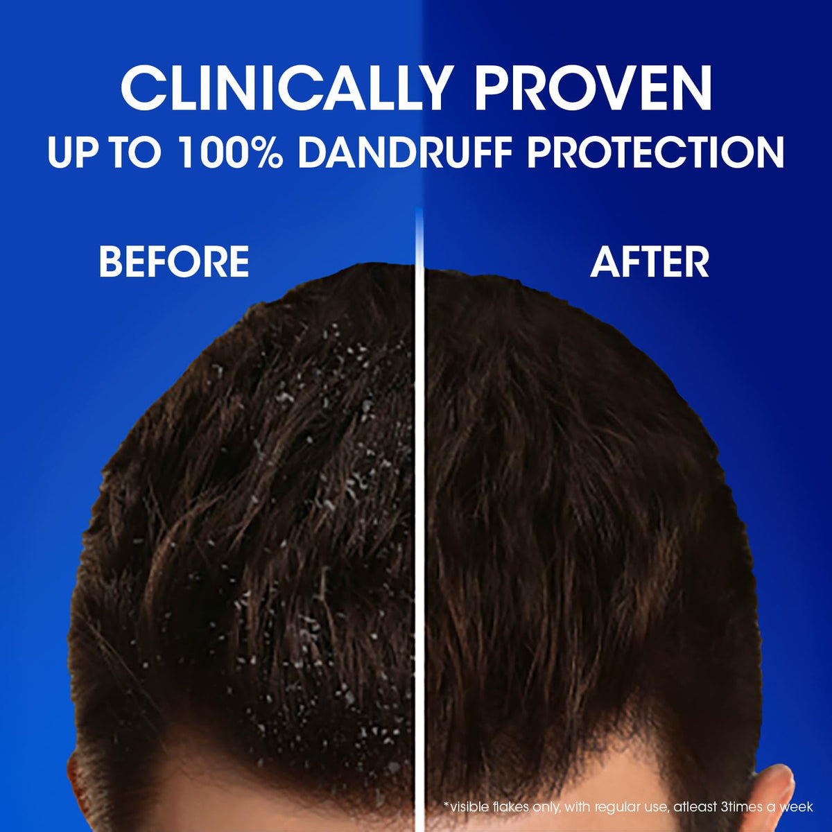 Head & Shoulders, Anti-Hairfall, Anti-Dandruff Shampoo for Women & Men , 650ml