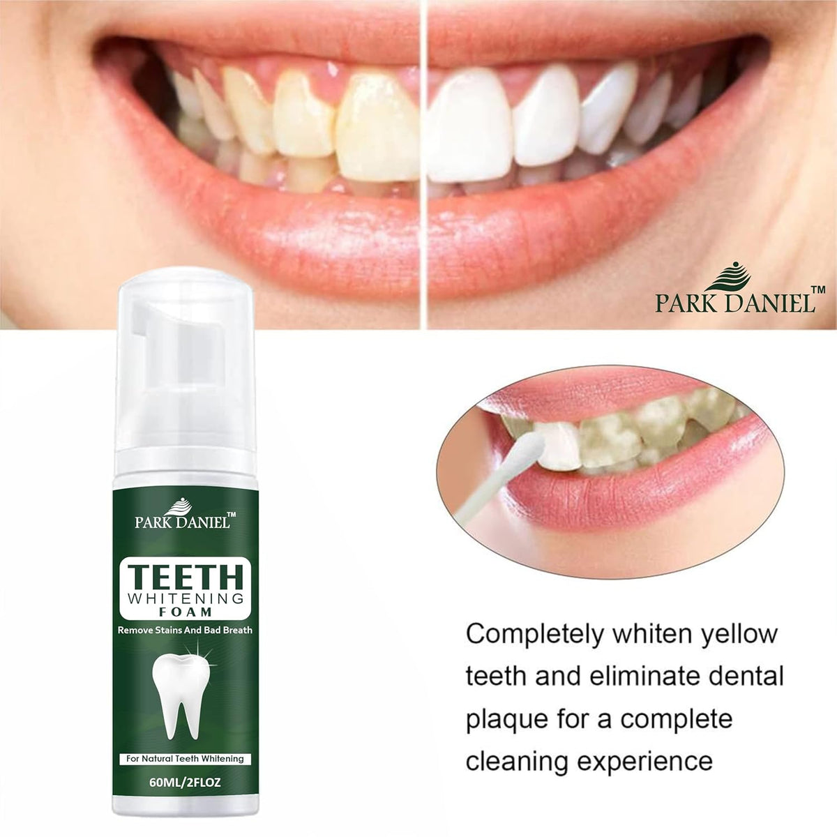 Park Daniel Teeth Lightening Foam To Remove Yellow Stains, Tobacoo, Tartar And Tobacco Stains, Brightening, Pack Of 1 Of 60 Ml, 1 Count