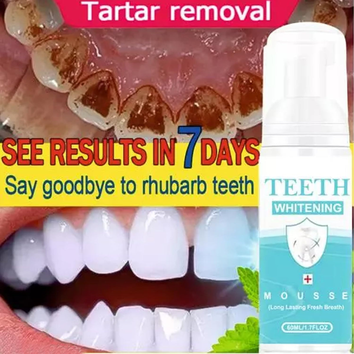 Whitening Dental Mousse,Tea Stain Removal Foaming Tooth Cleanser Travel-Size Dentist Formulated [50ml]