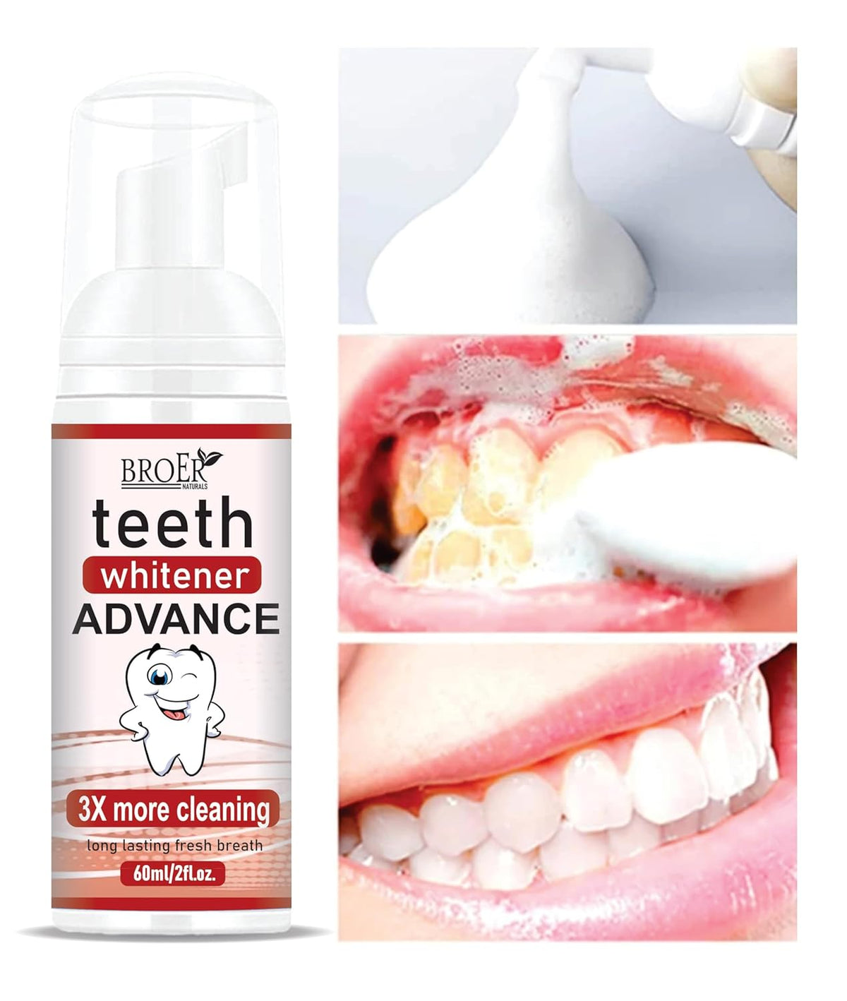 BROER Teeth Whitener ADVANCE | Teeth Whitening Foam To Remove Yellow Stains, Tobacoo, Tartar and Tobacco Stains - 60ml