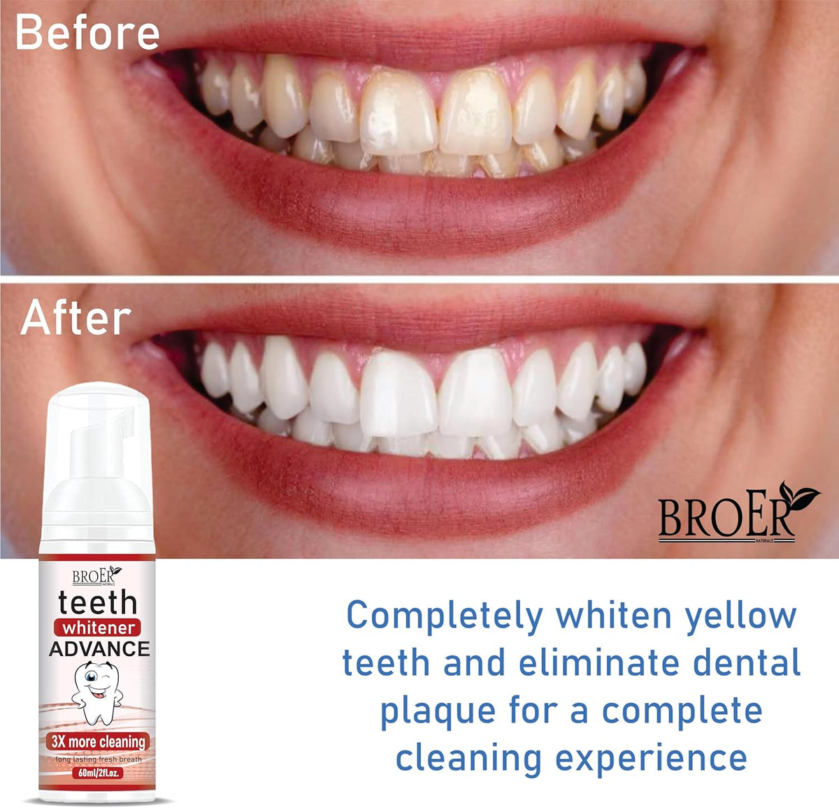 BROER Teeth Whitener ADVANCE | Teeth Whitening Foam To Remove Yellow Stains, Tobacoo, Tartar and Tobacco Stains - 60ml