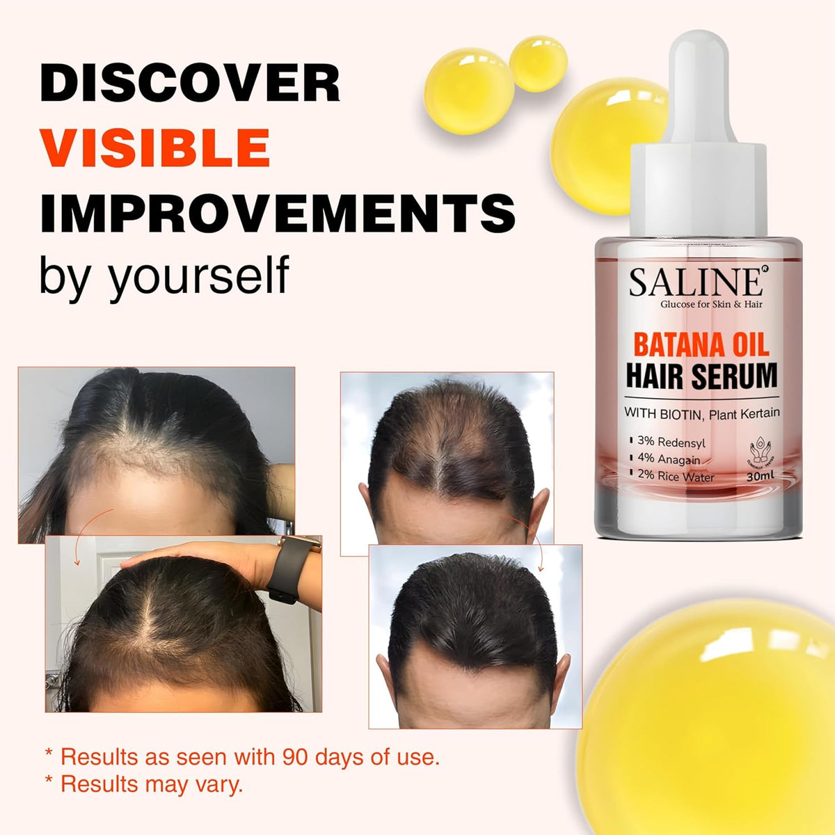 SALINE Batana Redensyl Hair Growth Serum with Biotin, 3% Redensyl, 4% Anagain, 2% Rice Water, and Plant Keratin 30ml - Hair Growth Serum for Men & Women